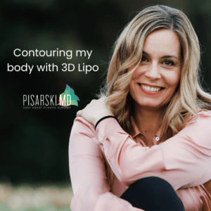Contouring-my-body-with-3d-lipo-lake-jackson-texas