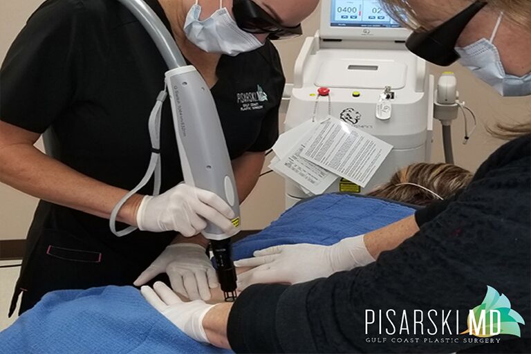 Tattoo removal