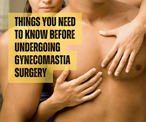 Gynecomastia Surgery – What You Need to Know Before Surgery