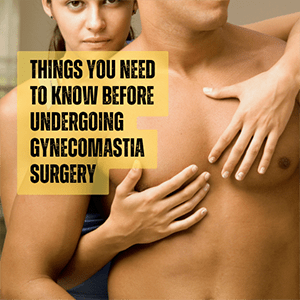 Gynecomastia Surgery – What You Need to Know Before Surgery