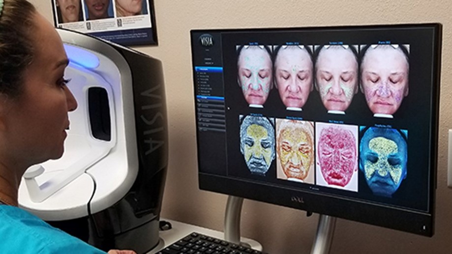 VISIA Complexion Analysis in Lake Jackson, TX